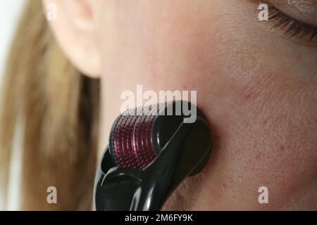 Massaggio facciale con microneedle dermaroller per il trattamento di cicatrici, rughe e ringiovanimento facciale. Cura della pelle semplice ed economica a casa, clos Foto Stock