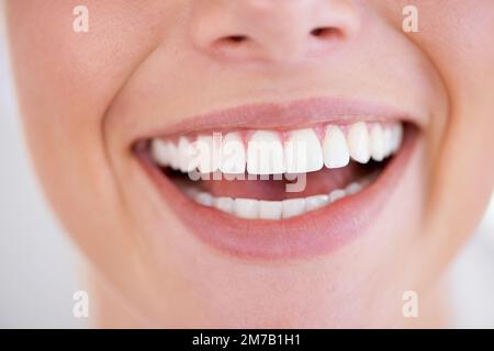 Con denti come questi non c'è scusa per non sorridere. Primo piano di una donna denti scintillanti. Foto Stock