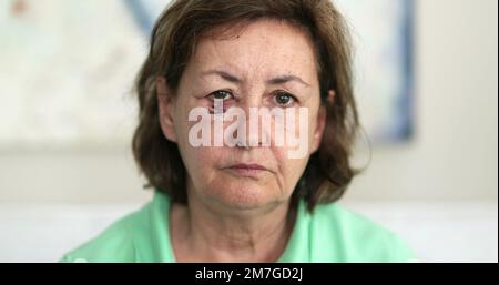 Donna più anziana con il viso ammaccato che guarda alla macchina fotografica. Donna anziana con cicatrice post-chirurgica per il cancro Foto Stock