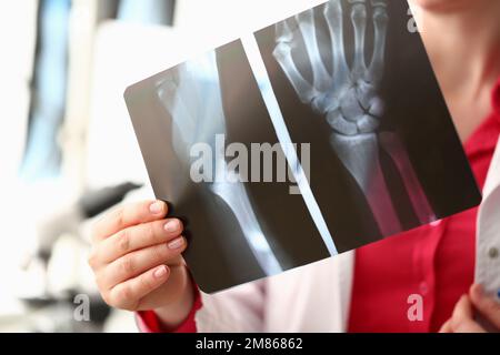 Medico che tiene radiografia delle mani in clinica Foto Stock