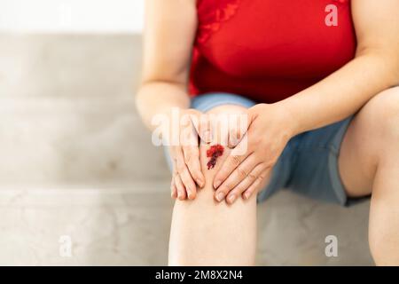 Primo piano delle gambe di una donna che inciampa e guarda una ferita con il sangue che scende le scale Foto Stock