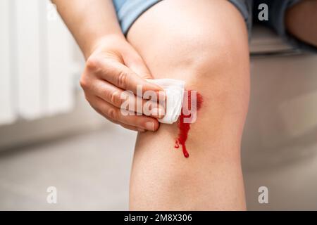 Donna che guarisce una ferita di primo soccorso del ginocchio dopo avere un incidente nel paese Foto Stock