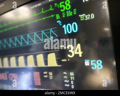 Monitor ospedalieri elettrocardiogramma pulsazioni apparecchi chirurgici per anestesia Foto Stock