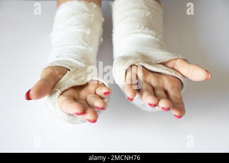 due mani femmine con polsi rotti dopo essere caduto da una bicicletta in un cast su uno sfondo isolato, mani in un cast Foto Stock