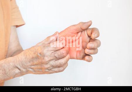 Donna anziana asiatica che graffia la mano. Concetto di malattie della pelle pruriginose come scabbia, infezione fungina, eczema, psoriasi, eruzione cutanea, allergia, ecc. Foto Stock