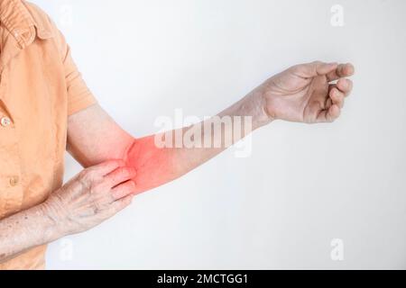 Donna anziana asiatica che graffia il braccio. Concetto di malattie della pelle pruriginose come scabbia, infezione fungina, eczema, psoriasi, eruzione cutanea, allergia, ecc. Foto Stock