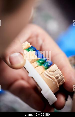 Dentista uomo dentista che lavora con dentiere nel suo laboratorio con cera e modello mascella, primo piano Foto Stock