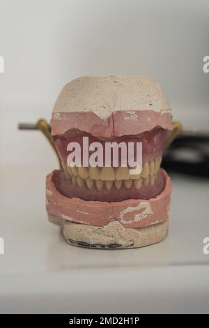 l'immagine di una dentiera in gesso sotto forma di stampo sul tavolo del dentista nella clinica dentale in attesa di essere controllata dal paziente Foto Stock