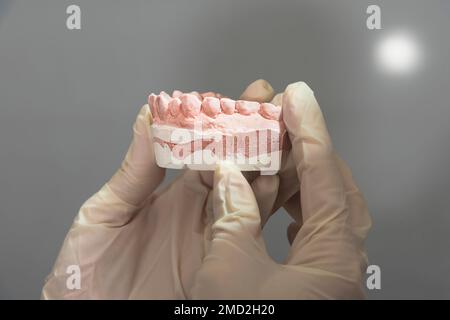 il dentista verifica una dentiera in gesso a forma di stampo nella clinica dentale in attesa di essere controllata dal paziente Foto Stock