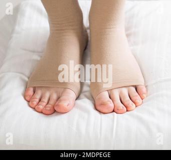 Gambe femminili calze a compressione per vene varicose sulle gambe. Sfondo bianco. Circolazione nelle gambe. trombosi nelle vene, linfedema. Foto Stock