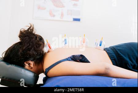 Agopuntura che cupa sul dorso di una persona sdraiata, paziente sdraiato con ventose sulla schiena. Fisioterapia che cupping su un paziente disteso. Foto Stock