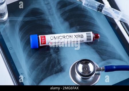 Provetta etichettata "OMICRON XBB VARIANT test positive" Foto Stock