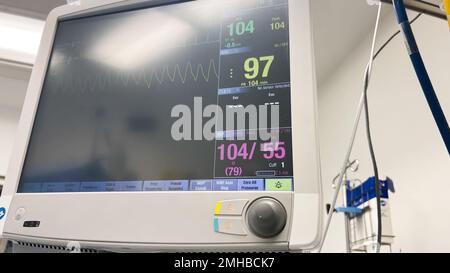 Ospedale monitora la pressione sanguigna della macchina per anestesia livello di ossigeno frequenza cardiaca Foto Stock