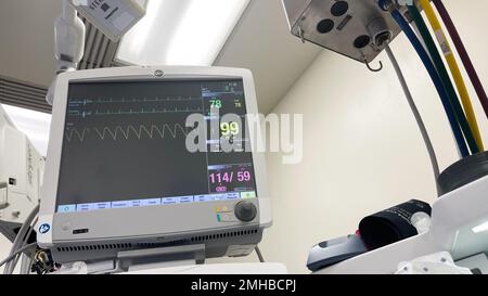 Ospedale monitora la pressione sanguigna della macchina per anestesia livello di ossigeno frequenza cardiaca Foto Stock