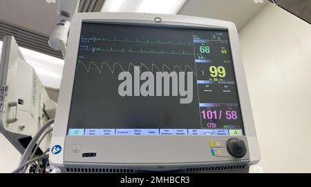 Ospedale monitora la pressione sanguigna della macchina per anestesia livello di ossigeno frequenza cardiaca Foto Stock