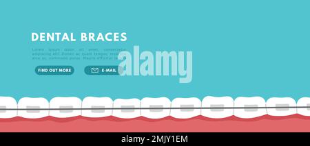 Banner denti rinforzati. Problema ortodontico, sorriso con staffe, fermo. Illustrazione con isolamento vettoriale piatto Illustrazione Vettoriale