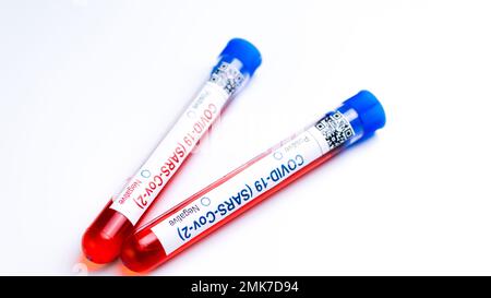 matracci con analisi del sangue per virus della vaiolo scimmia positivo e negativo, mpox Foto Stock