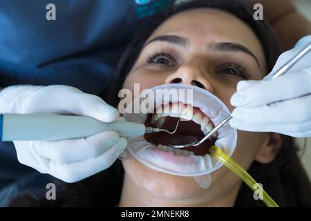 I denti di una donna vengono curati in clinica. Un ortodontista utilizza strumenti dentali per posizionare le bretelle sui denti del paziente. Messa a fuoco selettiva Foto Stock