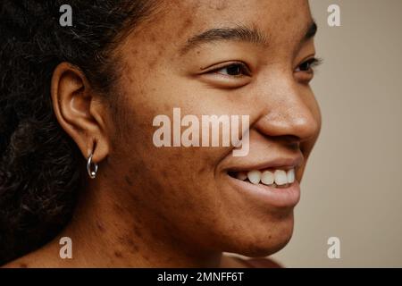 Primo piano ritratto di etnia giovane donna con cicatrici acne sul viso sorridente contro neutro sfondo beige, vera bellezza Foto Stock