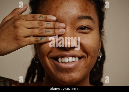 Primo piano ritratto di etnia giovane donna sorridente candidamente con un occhio chiuso, pelle struttura cicatrici acne Foto Stock