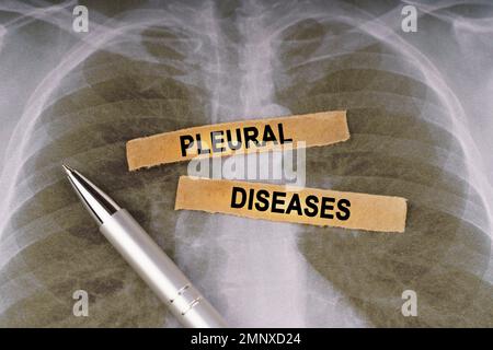 Concetto medico. Su una radiografia del torace umano, una penna e strisce di carta etichettate - MALATTIE PLEURICHE Foto Stock