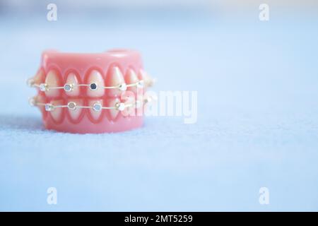 Base per dentiera ortodontica in metallo. Nessuna gente Foto Stock