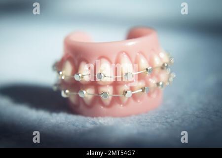 Base per dentiera ortodontica in metallo. Nessuna gente Foto Stock