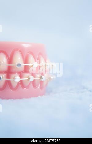 Base per dentiera ortodontica in metallo. Nessuna gente Foto Stock