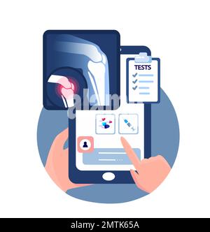 Touch screen online Rheumatology Ortopedia Traumatologia Chirurgia Mobile Application.smartphone radiografia a raggi X,dolore nell'articolazione del ginocchio. Infiammazione del fronte Foto Stock