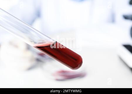 Provetta con campione di sangue su sfondo sfocato, primo piano. Ricerca sui virus Foto Stock
