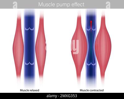 Effetto pompa muscolare scheletrica. Illustrazione dell'effetto della pompa muscolare sul ritorno venoso e sul sangue muscolare. I muscoli dei polpacci si contraggono e si rilassano Illustrazione Vettoriale