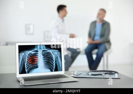 Medico consulente uomo in clinica, vista offuscata. Concentrarsi sul laptop che visualizza i raggi X di un paziente affetto da cancro polmonare Foto Stock