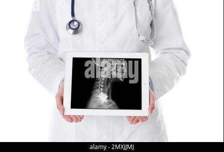 Medico che mostra radiografia di un paziente con cancro sulla compressa su sfondo bianco, primo piano Foto Stock