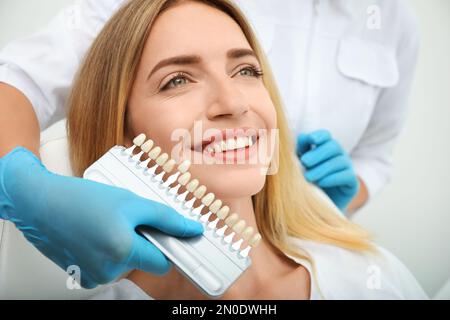 Medico che abbina il colore dei denti del paziente con la tavolozza, primo piano. Odontoiatria cosmetica Foto Stock