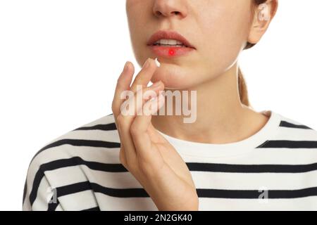 Donna con herpes applicare crema sul labbro su sfondo bianco, primo piano Foto Stock