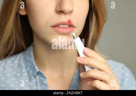 Donna con herpes applicare crema sul labbro su sfondo grigio chiaro, primo piano Foto Stock