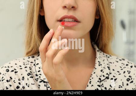 Donna con herpes applicare crema sul labbro su sfondo sfocato, primo piano Foto Stock