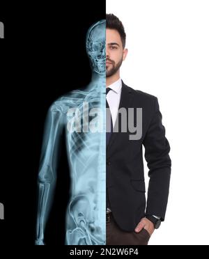 Uomo in tuta, fotografia a mezza radiografia. Controllo medico Foto Stock