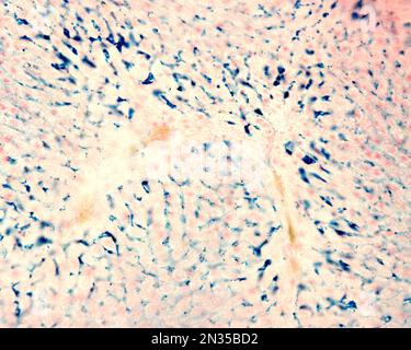 Le cellule di Kupffer sono macrofagi del fegato. Il ferro colloidale funge da colorante vitale che può essere introdotto nel corpo fagocitato dalle cellule di Kupffer, Foto Stock
