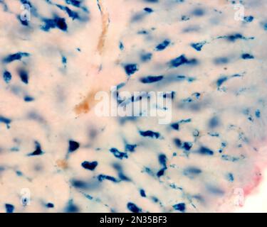 Le cellule di Kupffer sono macrofagi del fegato. Il ferro colloidale funge da colorante vitale che può essere introdotto nel corpo fagocitato dalle cellule di Kupffer, Foto Stock