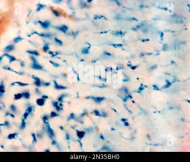 Le cellule di Kupffer sono macrofagi del fegato. Il ferro colloidale funge da colorante vitale che può essere introdotto nel corpo fagocitato dalle cellule di Kupffer, Foto Stock