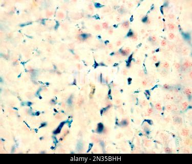 Le cellule di Kupffer sono macrofagi del fegato. Il ferro colloidale funge da colorante vitale che può essere introdotto nel corpo fagocitato dalle cellule di Kupffer, Foto Stock