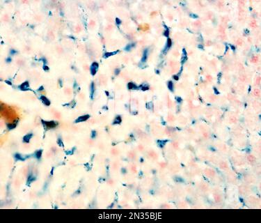 Le cellule di Kupffer sono macrofagi del fegato. Il ferro colloidale funge da colorante vitale che può essere introdotto nel corpo fagocitato dalle cellule di Kupffer, Foto Stock