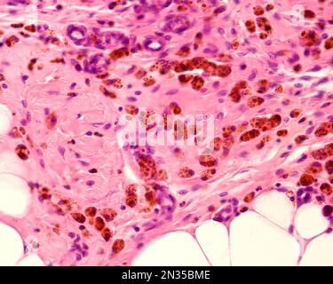 Grasso peritoneale che mostra macrofagi marcati con ferro colloidale. Il ferro colloidale può essere utilizzato come colorante vitale per marcare i macrofagi. Colloidale circolante Foto Stock