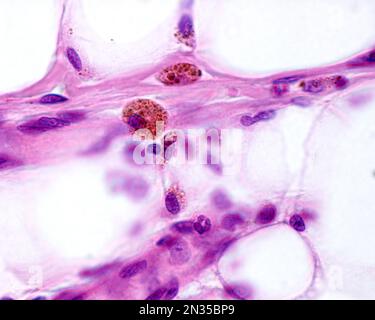 Macrofagi fortemente marcati con ferro colloidale. Il ferro colloidale può essere utilizzato come colorante vitale per marcare i macrofagi. Il ferro colloidale circolante è fago Foto Stock