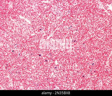 Il blu tripan è una macchia vitale che può essere introdotta nel corpo. Il blu di Trypan circolante è fagocitato dai macrofagi che diventano marcati in blu. LIG Foto Stock