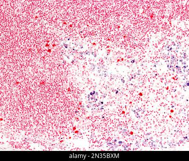 Il blu tripan è una macchia vitale che può essere introdotta nel corpo. Il blu di Trypan circolante è fagocitato dai macrofagi che diventano marcati in blu. LIG Foto Stock