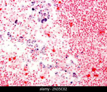 Il blu tripan è una macchia vitale che può essere introdotta nel corpo. Il blu di Trypan circolante è fagocitato dai macrofagi che diventano marcati in blu. LIG Foto Stock