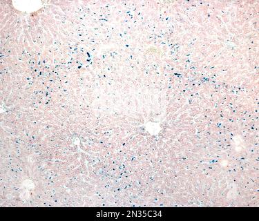 Le cellule epatiche di Kupffer sono macrofagi correlati alle sinusoidi epatiche. Quando le cellule di Kupffer fagocitano il blu di Trypan circolante, una macchia vitale che può b Foto Stock