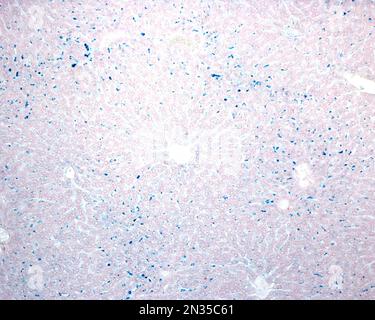 Le cellule epatiche di Kupffer sono macrofagi correlati alle sinusoidi epatiche. Quando le cellule di Kupffer fagocitano il blu di Trypan circolante, una macchia vitale che può b Foto Stock